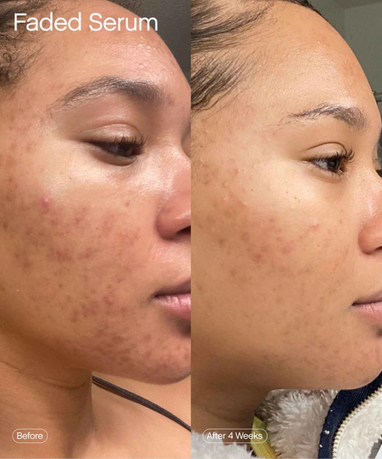 Topicals Faded Brightening and Clearing Serum