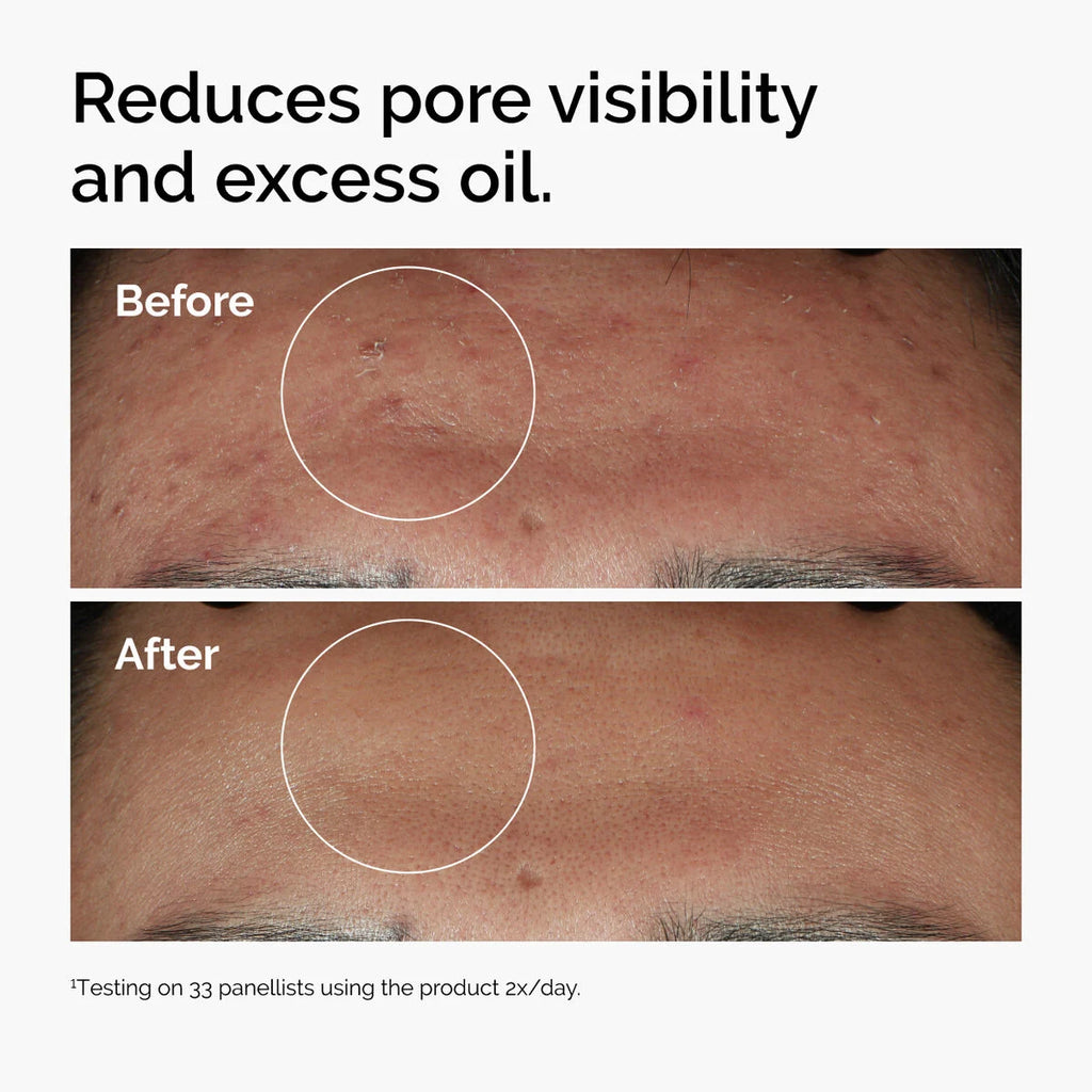 The Ordinary Niacinamide 10% + Zinc 1% 30ml.