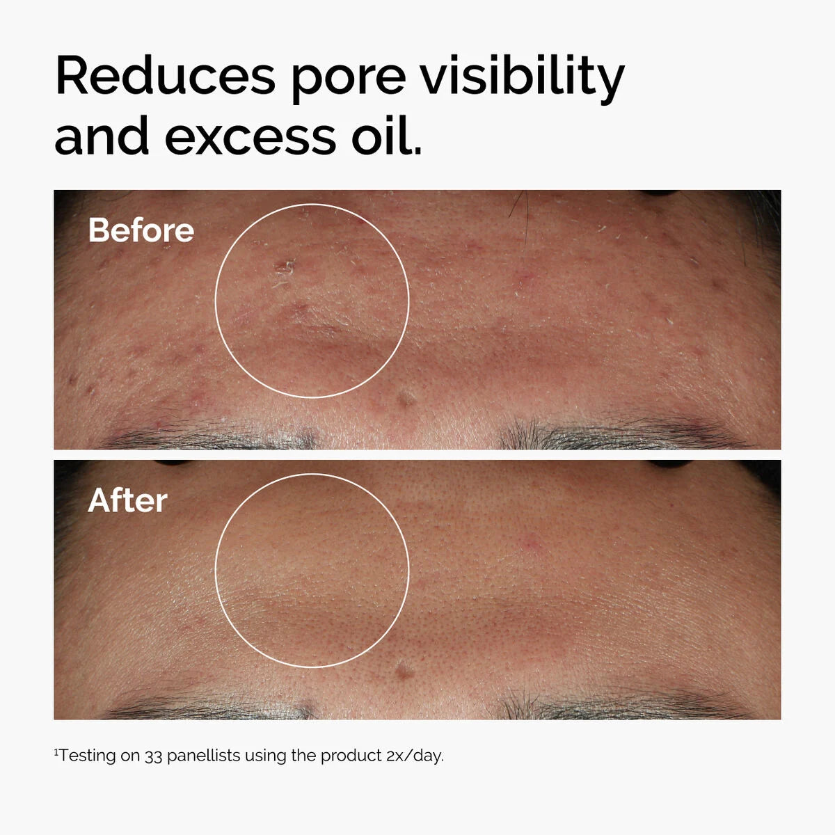 The Ordinary Niacinamide 10% + Zinc 1% 30ml.