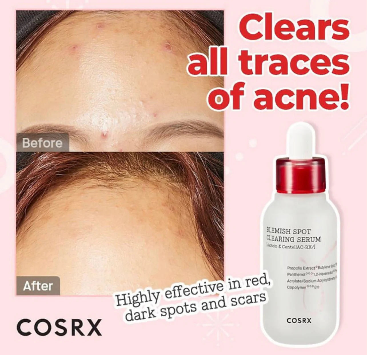 Cosrx - AC Collection Blemish Spot Clearing Serum 40ml