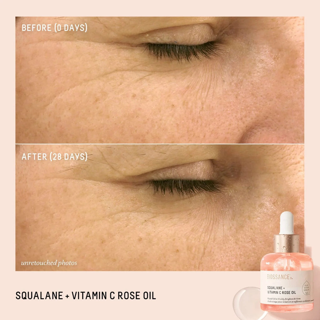 Biossance Vitamin C Rose Brightening and Firming Face Oil + Squalane