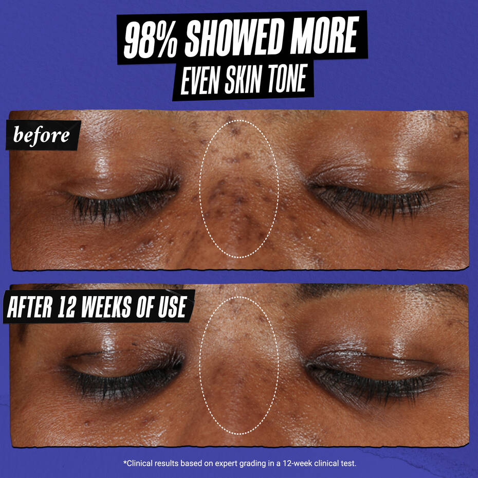 Kiehl’s Clearly Corrective Dark Spot Serum