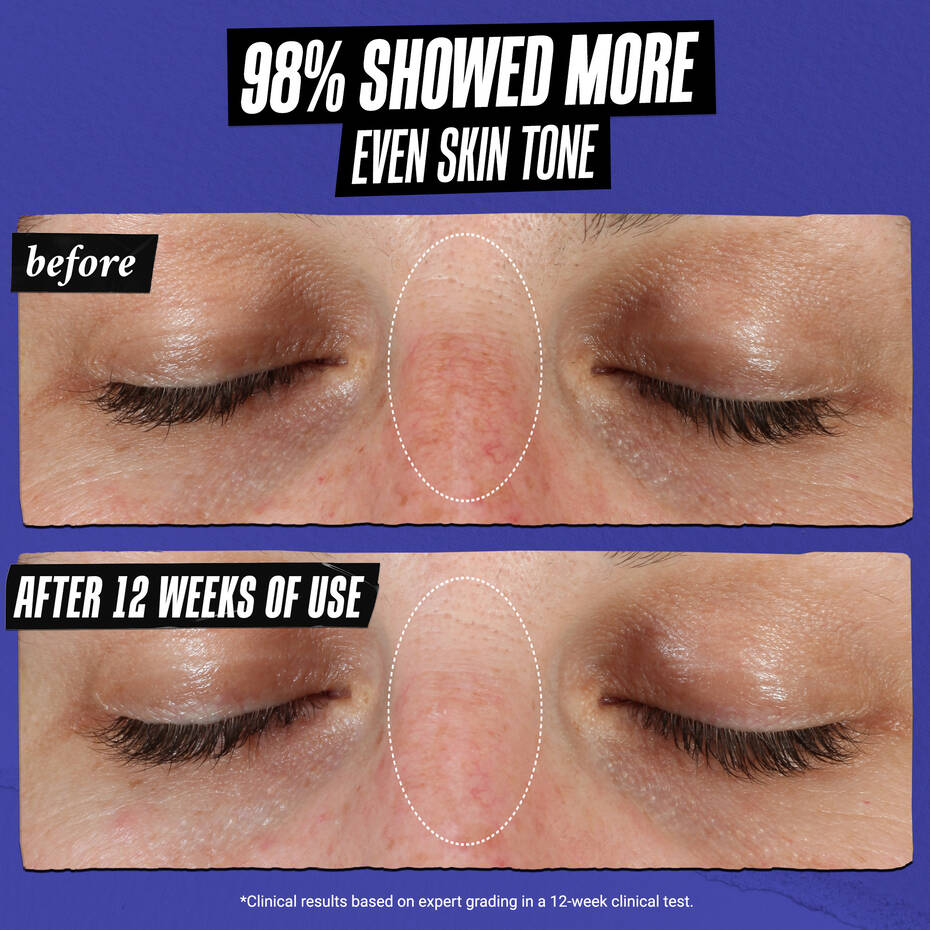 Kiehl’s Clearly Corrective Dark Spot Serum